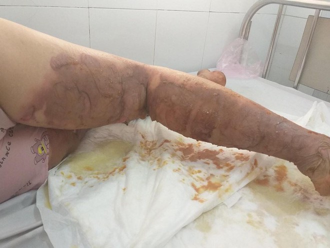 Vụ chủ cửa h&agrave;ng quần &aacute;o bị kẻ bịt mặt n&eacute;m bom xăng: Họ x&ocirc;ng v&agrave;o đ&aacute;nh t&ocirc;i v&agrave; dọa đốt 2 lần rồi - Ảnh 3.