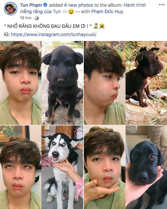 Vlogger Tun Phạm khoe ảnh nhổ răng khôn và chứng minh nỗi khổ thấu trời xanh mà ai cũng gặp phải sau đó - Ảnh 2.