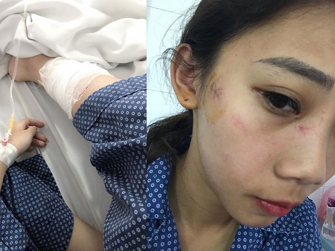 Hà Nội: 2 cô gái trẻ bị nhóm thanh niên trêu ghẹo, hành hung phải nhập viện - Ảnh 1.