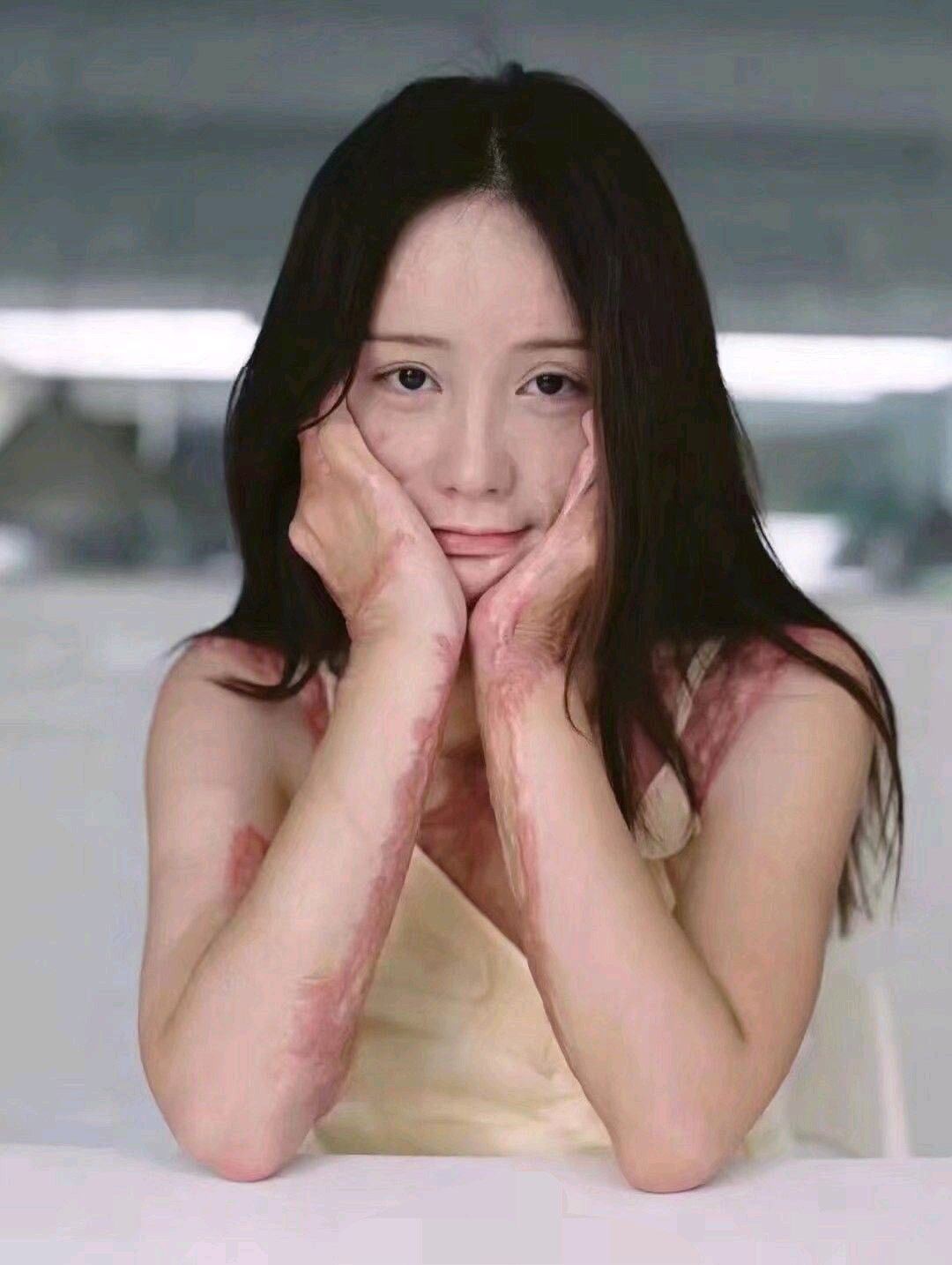 "Ăn không được đạp đổ" ! Kẻ cuồng yêu tạt axit cô gái vì bị từ chối hết 2 lần!
