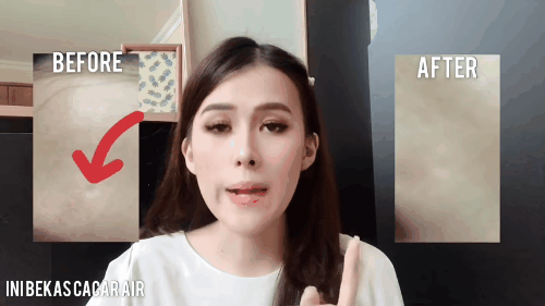 Serum nhầy ốc s&ecirc;n l&agrave;m đầy sẹo rỗ hot rần rần, bạn sẽ biết n&ecirc;n mua hay kh&ocirc;ng khi xem loạt review người thật việc thật n&agrave;y - Ảnh 7.