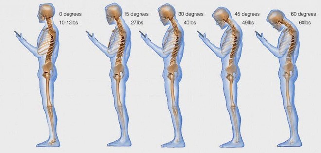 4 cách loại bỏ “bệnh công nghệ” ảnh hưởng rất xấu đến vai gáy của bạn - Ảnh 3.