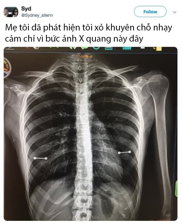 Nếu bạn có một ngày tồi tệ, chớ vội buồn vì ít ra bạn vẫn chưa thê thảm bằng đám người dưới đây - Ảnh 10.