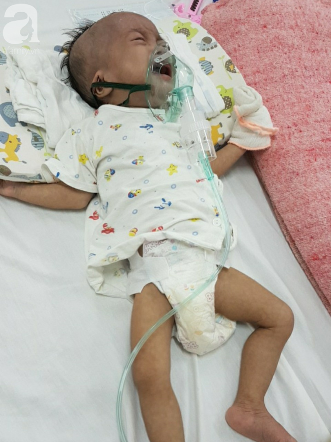 Tiếng khóc xé lòng của bé gái 14 tháng tuổi bị xơ phổi nặng, chỉ vỏn vẹn 5kg bên người mẹ mắc bệnh động kinh - Ảnh 1.