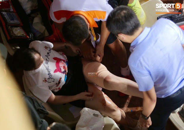 Trước vụ nữ CĐV bị bỏng do ph&aacute;o s&aacute;ng, thế giới từng chứng kiến thảm kịch tồi tệ do đ&aacute;m đ&ocirc;ng hooligan g&acirc;y ra tr&ecirc;n kh&aacute;n đ&agrave;i khiến 39 người chết - Ảnh 1.