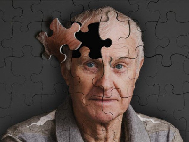  Công bố mới: Đã có vắc-xin đặc trị chứng mất trí Alzheimer  - Ảnh 1.