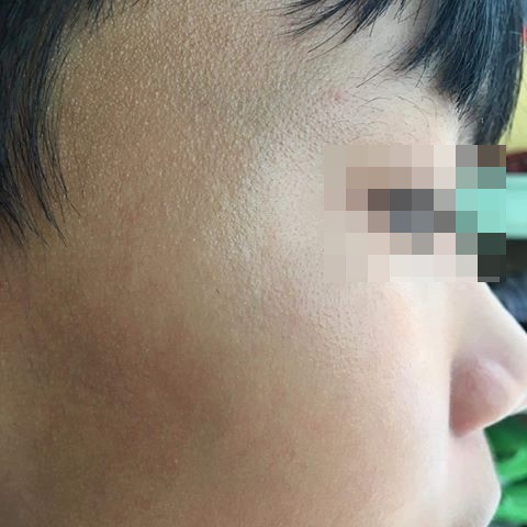 TP.HCM: Tài xế xe ôm công nghệ nghi hành hung học sinh lớp 9 dẫn đến chấn thương vì đứng sai điểm đón - Ảnh 2.