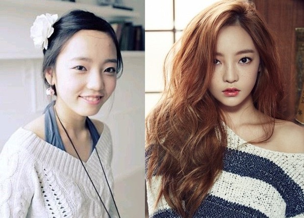 Tréo ngoe đời tư mỹ nhân dao kéo showbiz: Goo Hara - Trịnh Sảng xinh đẹp hoàn hảo lại thua xa mỹ nhân Chuyện tình Paris - Ảnh 12.