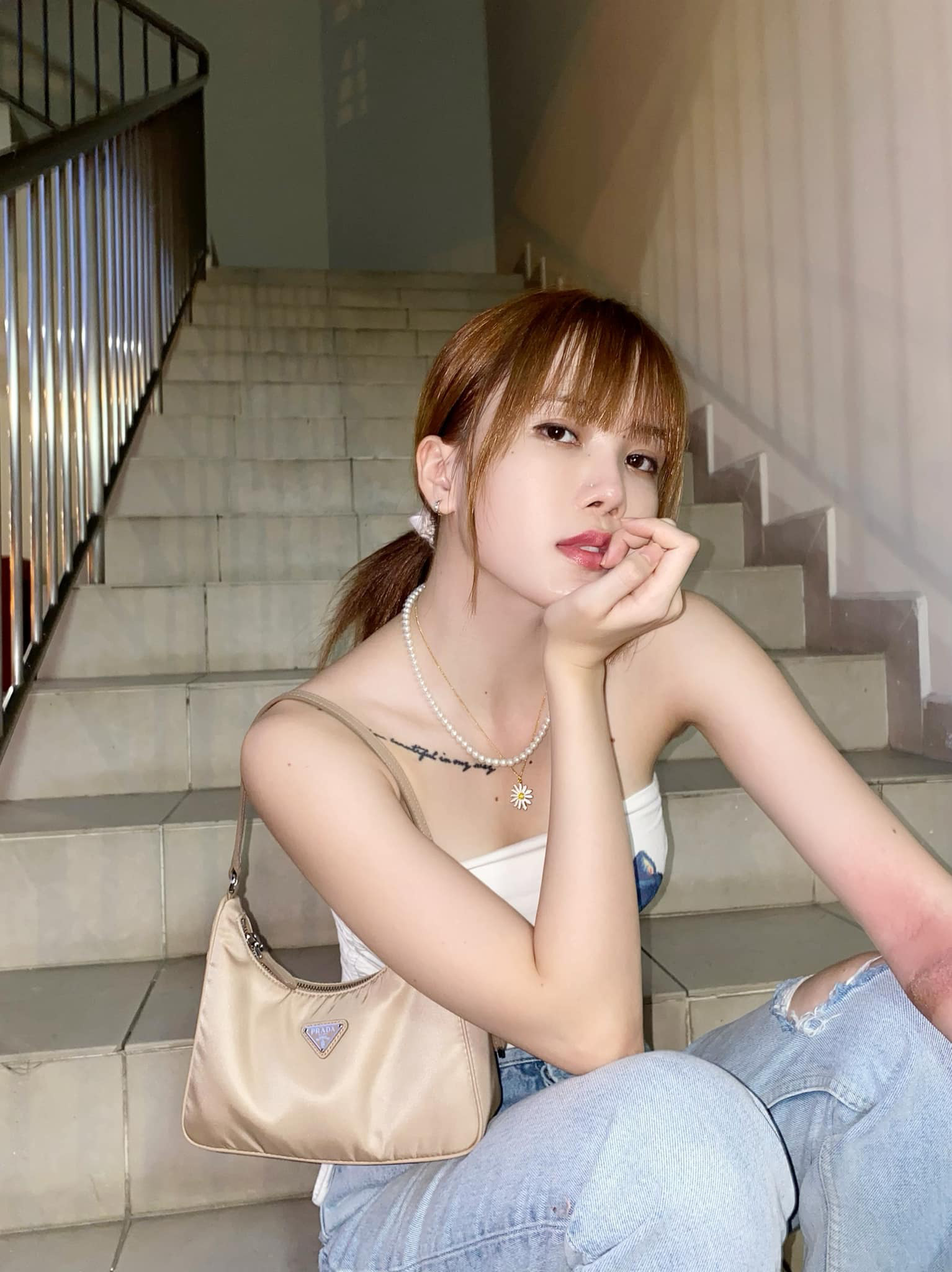 Thiều Bảo Trâm đăng ảnh tay chân bầm tím và chằng chịt vết thương, nguyên nhân được khổ chủ hé lộ luôn! - Ảnh 4.