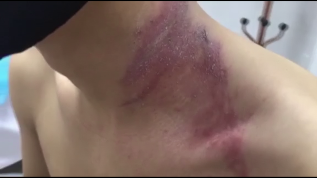 H&agrave; Nội ghi nhận h&agrave;ng ngh&igrave;n trường hợp nhiễm độc kiến ba khoang phải v&agrave;o viện - Ảnh 1.