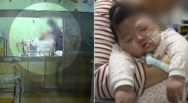 Em bé nhắm nghiền mắt trong sinh nhật đầu tiên tưởng như ngủ nhưng là kết quả của hành vi bạo hành bởi y tá gây chấn động Hàn Quốc 1 năm trước - Ảnh 3.