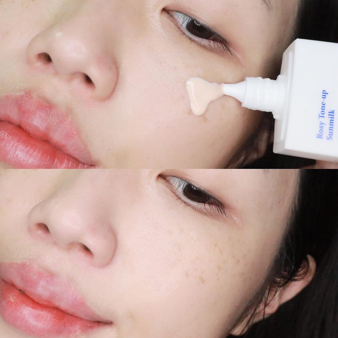 Biết 5 chiêu nặn mụn đúng cách, da sẽ nhanh lành, vết thâm cũng không có cửa xuất hiện - Ảnh 4. Biết 5 chiêu nặn mụn đúng cách, da sẽ nhanh lành, vết thâm cũng không có cửa xuất hiện - Ảnh 4.