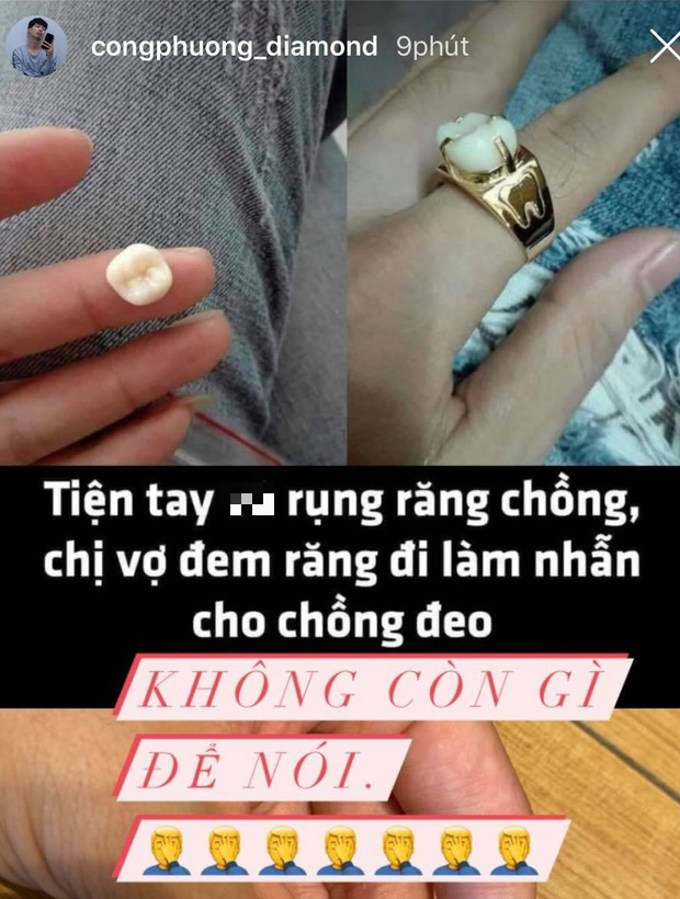 Công Phượng bình luận hài hước về sự việc vợ lấy răng chồng làm mặt nhẫn