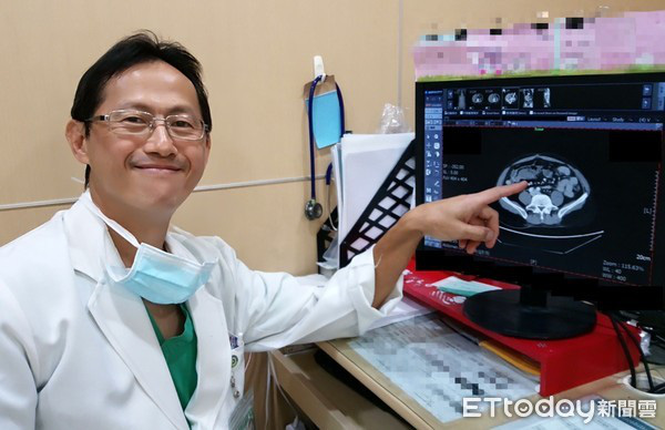 3 người trong 1 gia đình ở Đài Loan cùng mắc ung thư đại trực tràng, bác sĩ vạch trần nguyên nhân đến từ yếu tố di truyền của người mẹ - Ảnh 2.