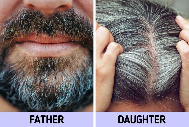 Không muốn tóc bạc sớm từ năm 20 tuổi, bạn nên chú ý tới 6 vấn đề là nguyên nhân điển hình gây ra tình trạng này - Ảnh 5.