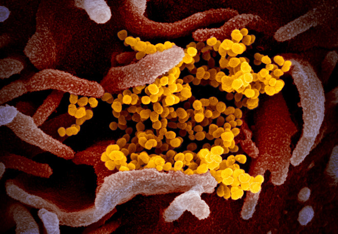 Hình ảnh của virus đáng sợ Covid-19 dưới ống kính hiển vi điện tử - Ảnh 2.