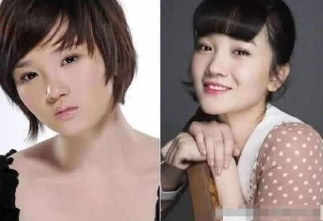 Mỹ nhân showbiz liều mạng làm đẹp: Từ Hy Viên uống thuốc chống đông máu, Song Ji Hyo thay máu để trở nên tươi trẻ - Ảnh 9.
