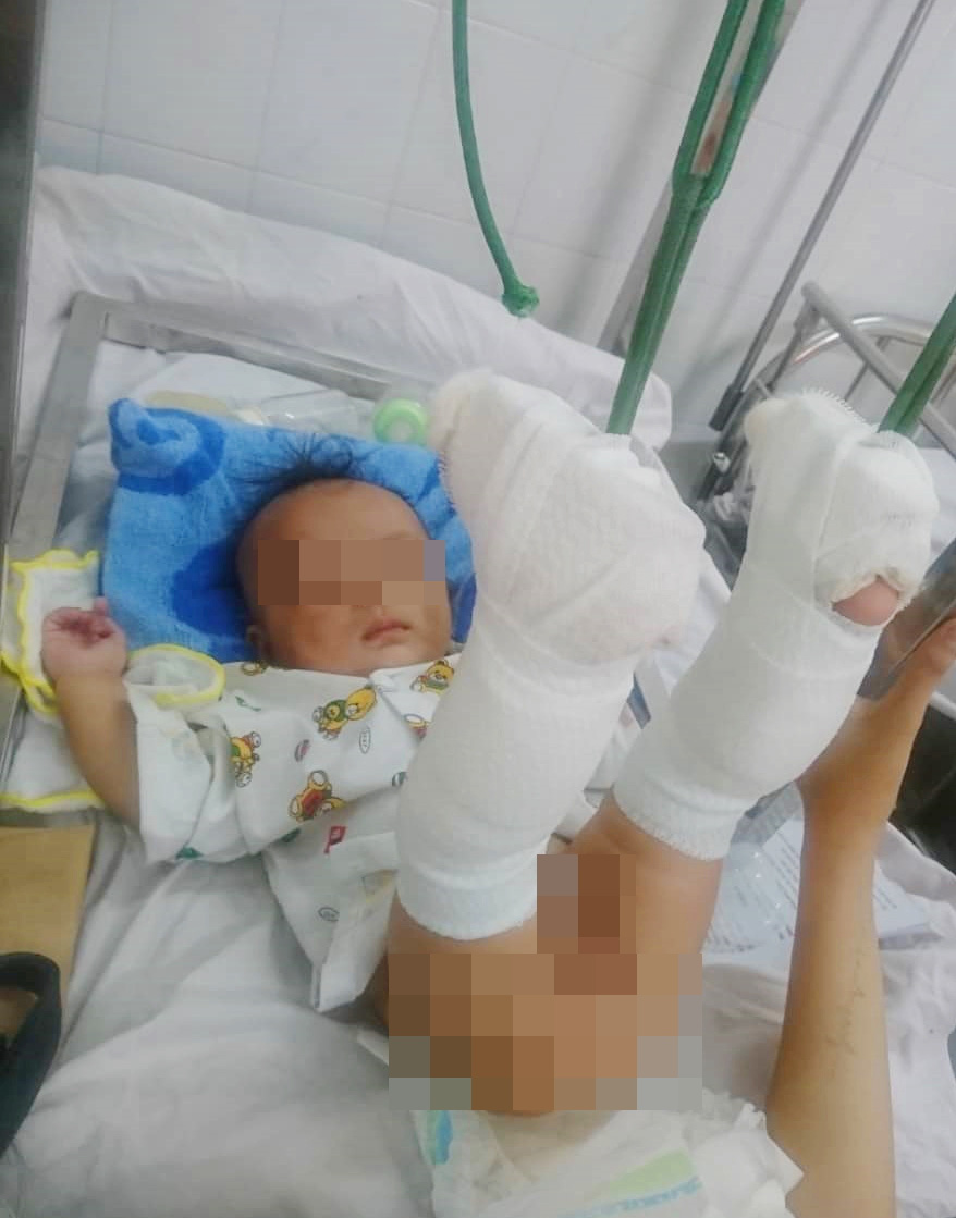 TP.HCM: Bé trai 4 tháng tuổi nghi bị cha ruột bạo hành đến gãy 2 ...