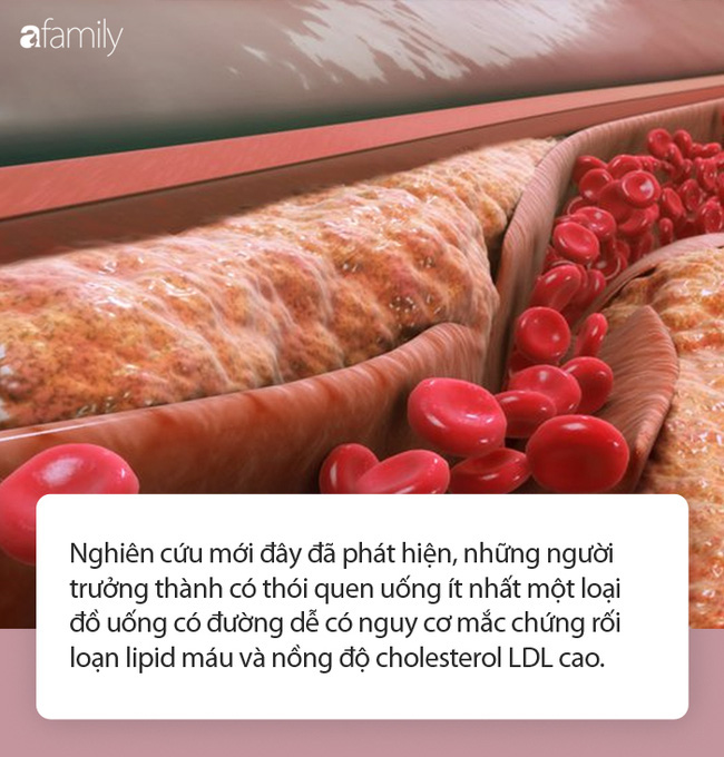 Đồ uống có đường ảnh hưởng thế nào tới sức khỏe tim mạch và nồng độ cholesterol? - Ảnh 1.