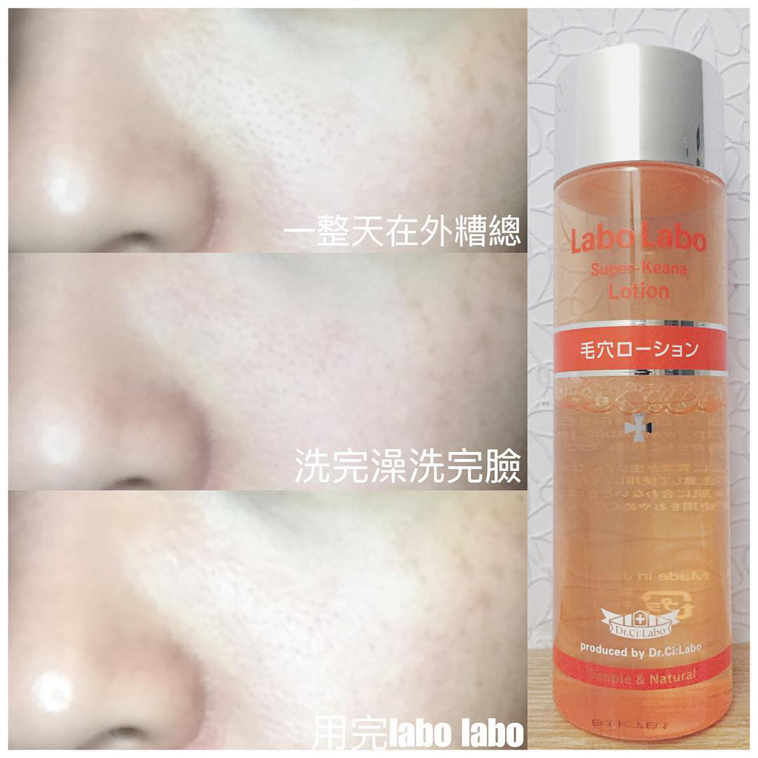 Tuyệt hơn cả serum, chai lotion bình dân Nhật Bản đã giúp lỗ chân lông của cô bạn này nhỏ mịn đi thấy rõ - Ảnh 3.