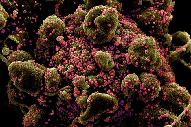 Tại sao virus SARS, MERS và SARS-CoV-2 đều cần một động vật trung gian trước khi lây sang người? - Ảnh 2.