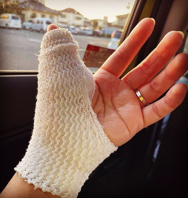 Dân mạng “thót tim” khi thấy bàn tay băng bó của Quỳnh Trần JP, nguyên nhân được hé lộ vì tai nạn nghề nghiệp khá nghiêm trọng - Ảnh 2.