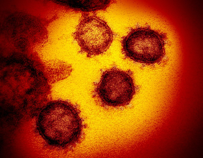 Giải ngố: Tại sao chúng ta không thể nhìn thấy virus SARS-CoV-2 bằng mắt thường, và làm thế nào để chụp được ảnh của chúng? - Ảnh 1.