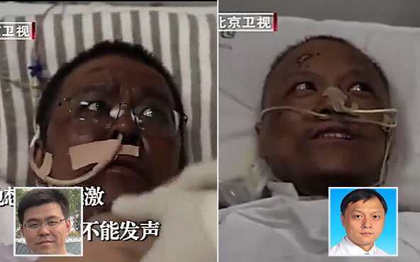 Hai bác sĩ Trung Quốc có làn da bị đổi sang màu nâu sau một thời gian dài chống chọi với Covid-19