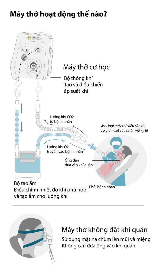 Máy thở được dùng thế nào và dùng ở giai đoạn nào trong việc điều trị Covid-19? - Ảnh 2.