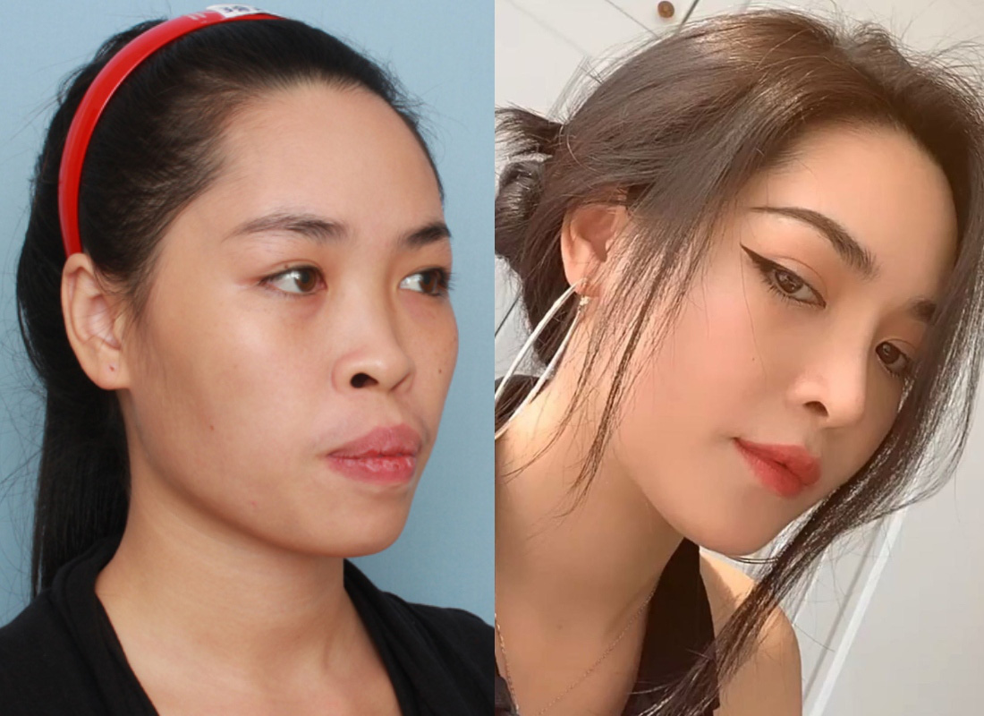 Từng bị sạm nám, lỗ chân lông to, Vũ Thanh Quỳnh “Người Ấy Là Ai” tiết lộ chiêu skincare giúp da căng mịn trẻ đẹp hơn cả 5 năm trước - Ảnh 1.