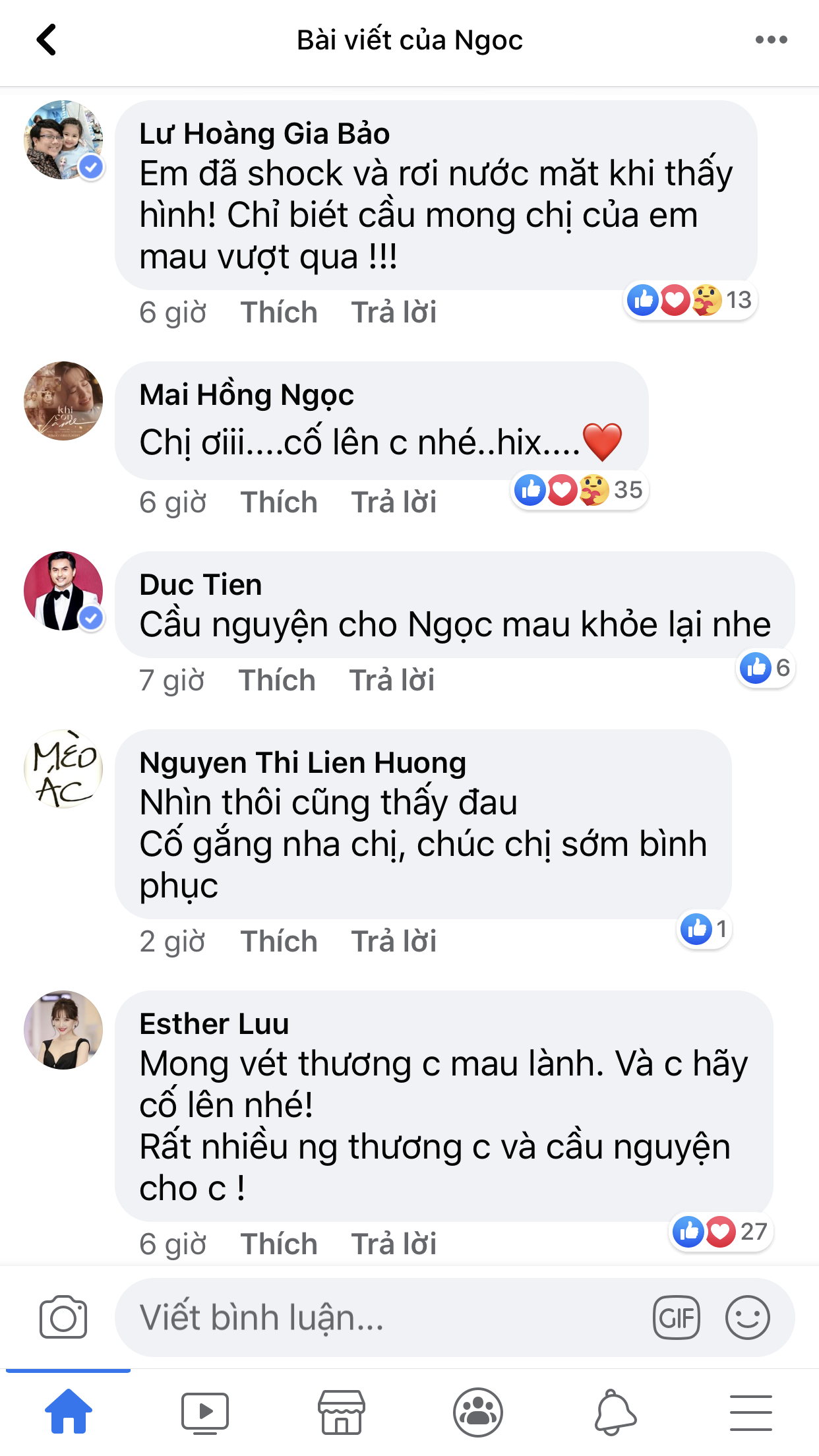 Ca sĩ Hồng Ngọc h&eacute; lộ ảnh cận vết bỏng nặng tr&ecirc;n mặt, d&agrave;n nghệ sĩ Vbiz chạnh l&ograve;ng rơi nước mắt - Ảnh 5.