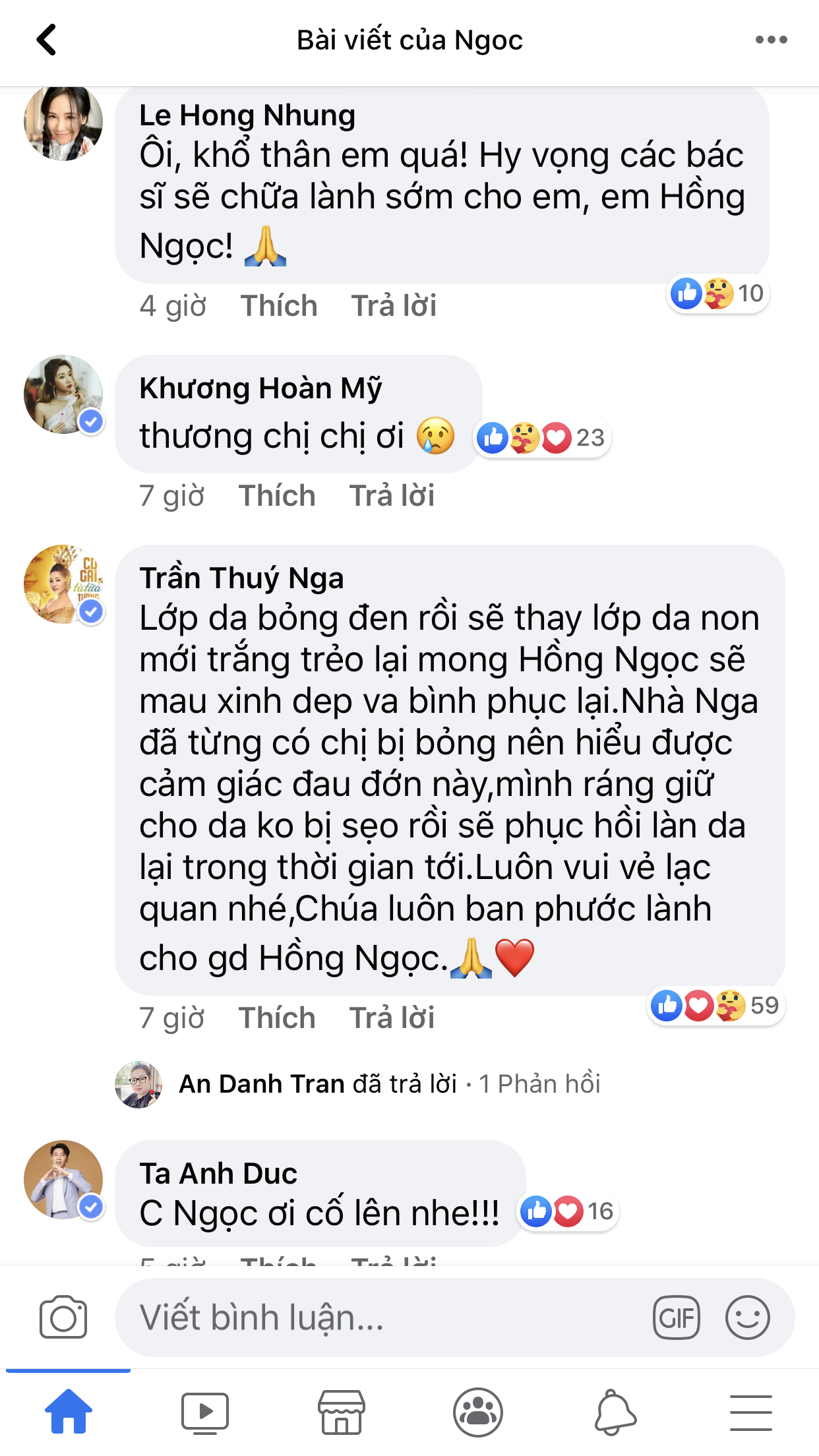 Ca sĩ Hồng Ngọc h&eacute; lộ ảnh cận vết bỏng nặng tr&ecirc;n mặt, d&agrave;n nghệ sĩ Vbiz chạnh l&ograve;ng rơi nước mắt - Ảnh 6.