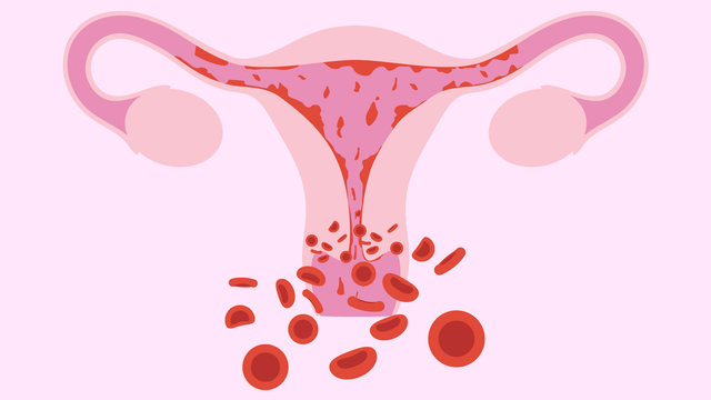 Chảy máu khi đang làm chuyện ấy: phái nữ có thể gặp phải 6 vấn đề ảnh hưởng không nhỏ đến việc sinh sản - Ảnh 4.