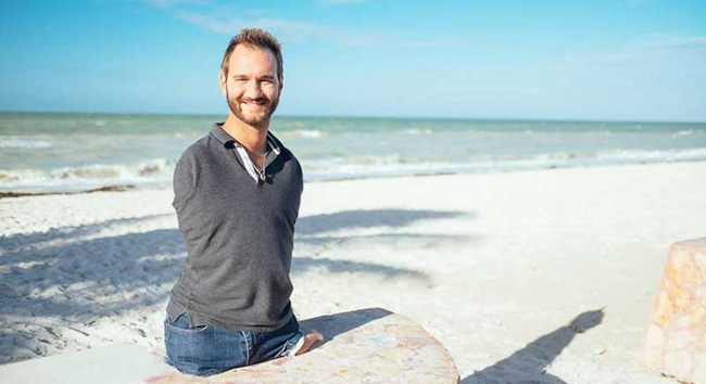 Xuất hiện em bé sinh ra không có cả tay lẫn chân, giống hệt hội chứng mà Nick Vujicic mắc phải - Ảnh 2.