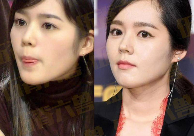 Loạt khoảnh khắc ngày ấy - bây giờ của 15 nữ thần Kbiz: Song Hye Kyo, Jeon Ji Hyun đều thay đổi, chỉ duy nhất Son Ye Jin lại được nhận xét thế này - Ảnh 7.