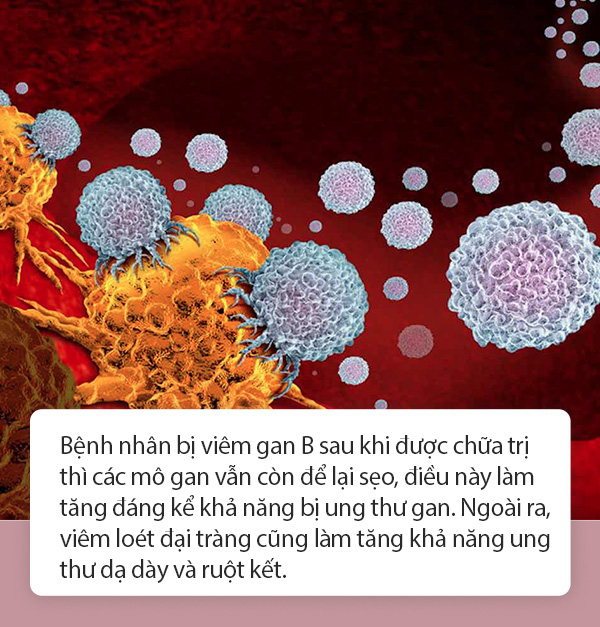 1/6 bệnh nhân ung thư có liên quan đến viêm: Nếu gặp tình trạng viêm ở 3 bộ phận này, tuyệt đối đừng chủ quan - Ảnh 1.