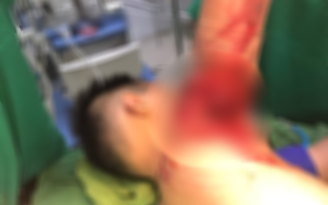 Va phải ch&acirc;n vịt thuyền th&uacute;ng khi đi tắm biển, b&eacute; trai nhập viện nguy kịch - Ảnh 1.