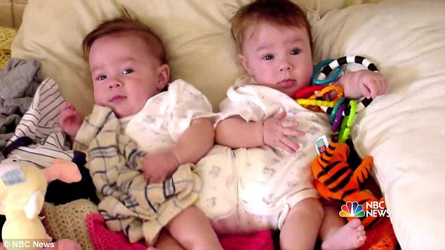 2 con gái sinh đôi dính liền, cha mẹ mất 7 tháng mới quyết định tách rời con, 17 năm sau ai cũng mãn nguyện khi thấy nụ cười của các em - Ảnh 4.