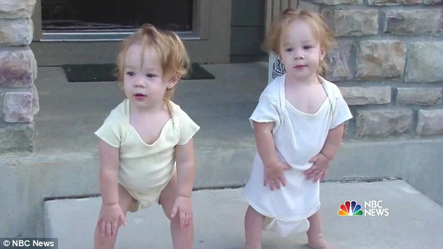 2 con gái sinh đôi dính liền, cha mẹ mất 7 tháng mới quyết định tách rời con, 17 năm sau ai cũng mãn nguyện khi thấy nụ cười của các em - Ảnh 5.