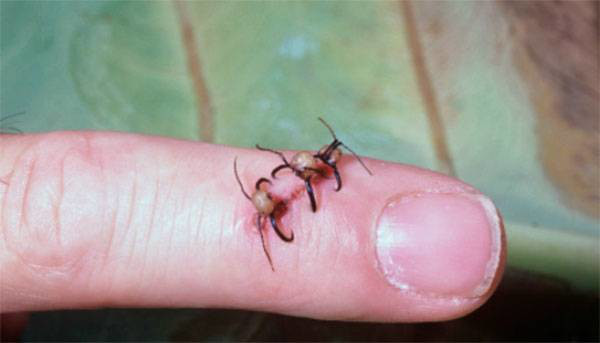 Loài kiến háu ăn nhất thiên nhiên: một ngày săn 500.000 con mồi, hàm răng nối lành được vết thương của người - Ảnh 4.