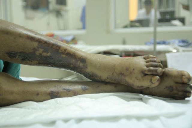 Người b&aacute;n v&eacute; số dạo tại Huế mắc li&ecirc;n cầu lợn chưa r&otilde; nguồn l&acirc;y - Ảnh 1.