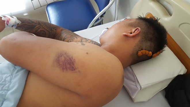 Người d&acirc;n tố 3 thanh ni&ecirc;n bị c&ocirc;ng an x&atilde; đ&aacute;nh nhập viện - Ảnh 2.