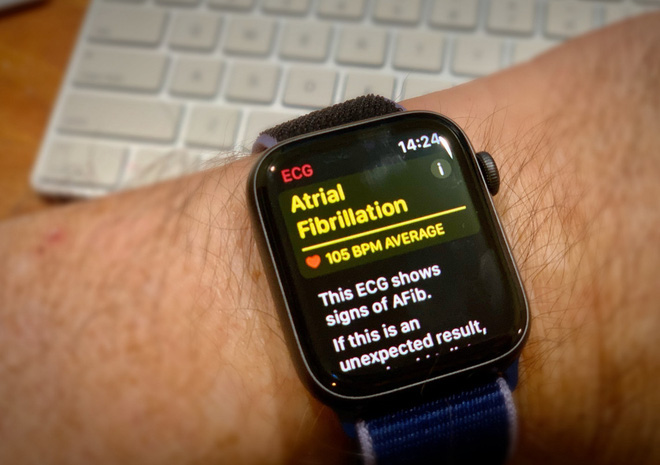 Kh&aacute;ch h&agrave;ng cảm ơn v&igrave; được Apple Watch cứu sống, CEO Tim Cook lập tức gửi mail cảm ơn lại - Ảnh 1.