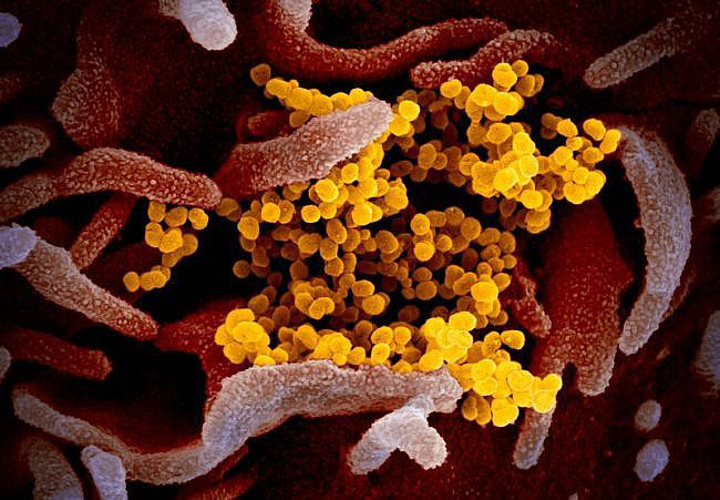 Nga phát triển thiết bị phát hiện virus SARS-CoV-2 trong không khí - Ảnh 1.