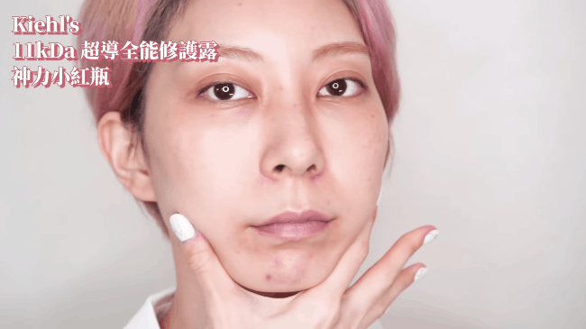 Beauty blogger xứ Đài trực tiếp check khả năng trị nám, trẻ hóa da của serum Kiehls: Sau 7 ngày vết thâm to mờ dần, vết nhỏ lặn mất tăm - Ảnh 1.
