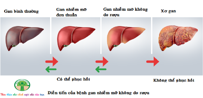 Nguyên Trưởng khoa Tiêu hóa BV Bạch Mai báo động: Có trẻ chưa lớp 1 gan đã trắng xóa mỡ - Ảnh 3.