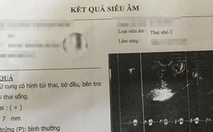 Vụ nữ sinh lớp 9 nghi bị bạn cưỡng bức có thai ở Thanh Hóa: Hiệu trưởng thừa nhận sự việc là bài học sâu sắc - Ảnh 1.