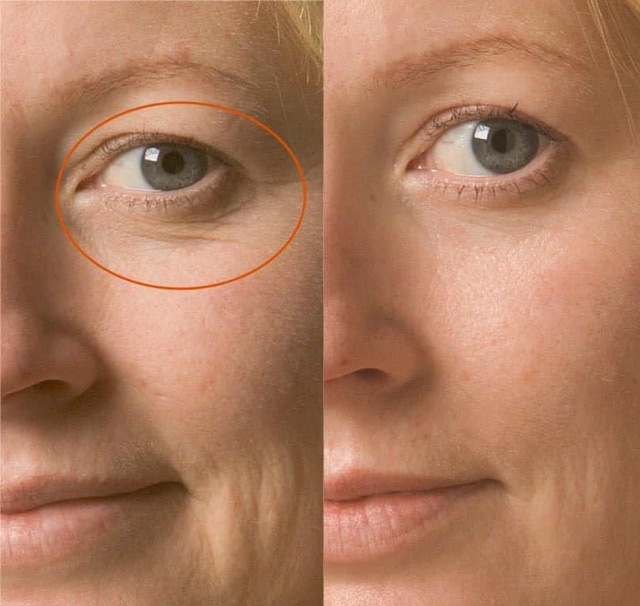 Da sạm hay thâm nám đến mấy cũng căng mịn, chỉ cần bạn chọn đúng 3 dòng retinol kiêm dưỡng ẩm vi diệu này - Ảnh 4.