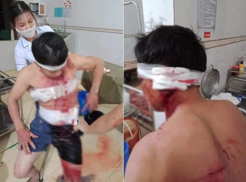 Điều tra vụ nhóm đối tượng xông vào nhà đánh người trọng thương - Ảnh 1. Điều tra vụ nhóm đối tượng xông vào nhà đánh người trọng thương - Ảnh 1.