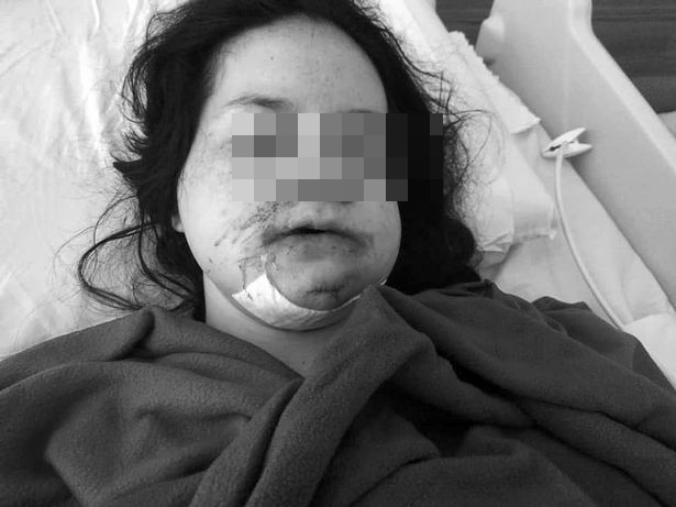 Vừa nói lời chia tay bạn trai, cô gái xinh đẹp hứng chịu tấn bi kịch rợn người suốt 8 ngày liên tục, nhìn vẻ ngoài hiện tại của cô ai cũng xót xa - Ảnh 4.